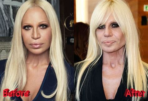 donatella versace sfilata 2017|donatella versace before and after surgery.